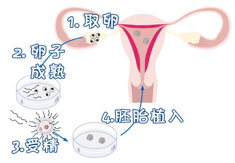包生男孩中介机构